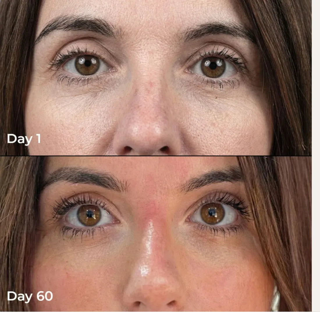 Before and after of skin with daily use